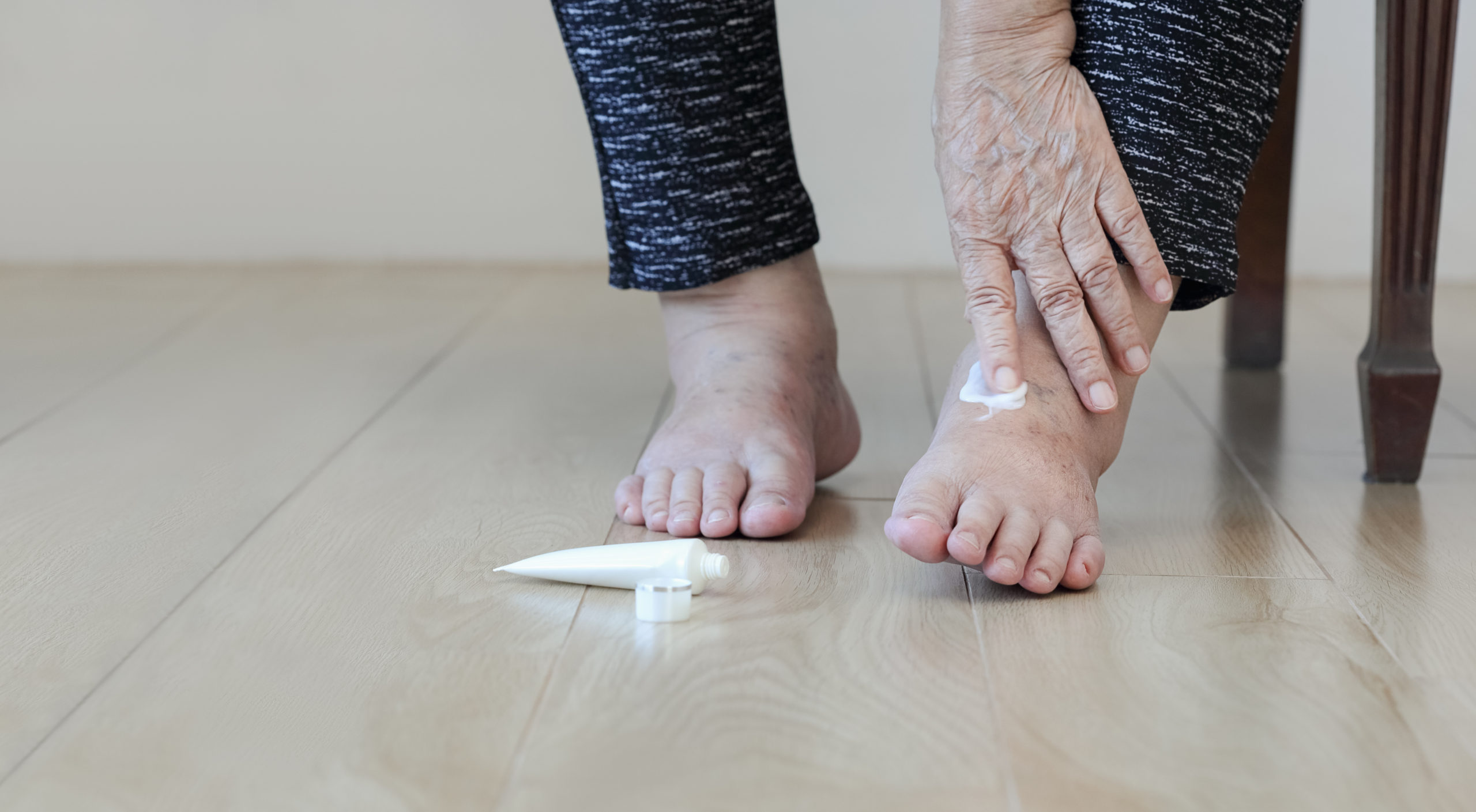 Elderly woman putting cream on swollen feet